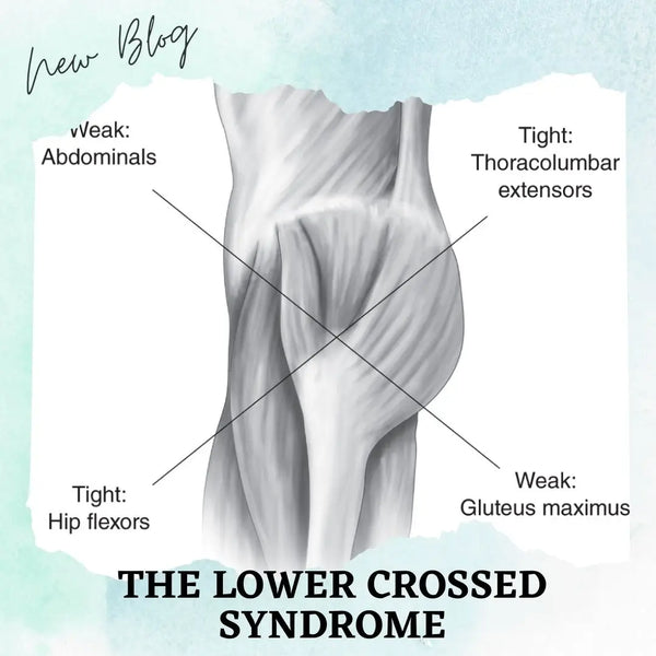 The Lower Crossed Syndrome